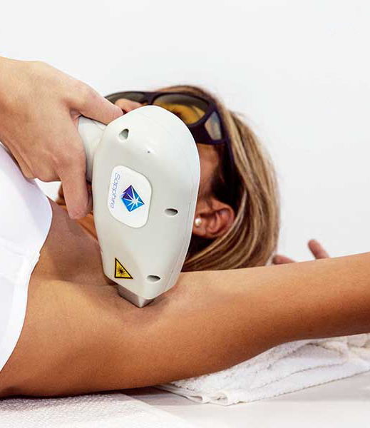 depilacio amb laser